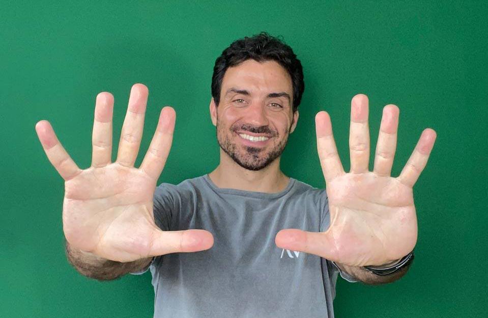 Matheus Macêdo mostrando os dez dedos das mãos